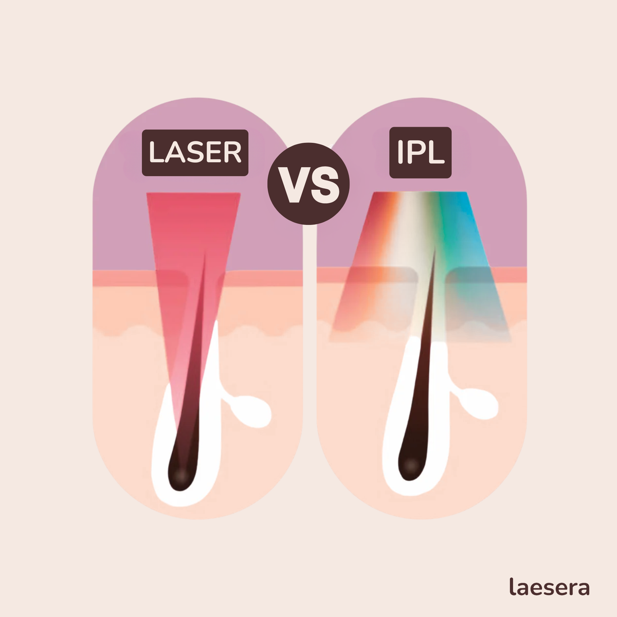 <p>Klinische effectiviteit van IPL</p>