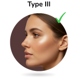 Fitzpatrick huidtype III – illustratie van een vrouw met donkere huid, aangeduid als niet geschikt voor IPL-ontharing (type III), informatieve visual over huidtype-geschiktheid.
