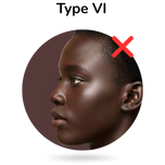 Fitzpatrick huidtype VI – illustratie van een vrouw met donkere huid, aangeduid als niet geschikt voor IPL-ontharing (type VI), informatieve visual over huidtype-geschiktheid.