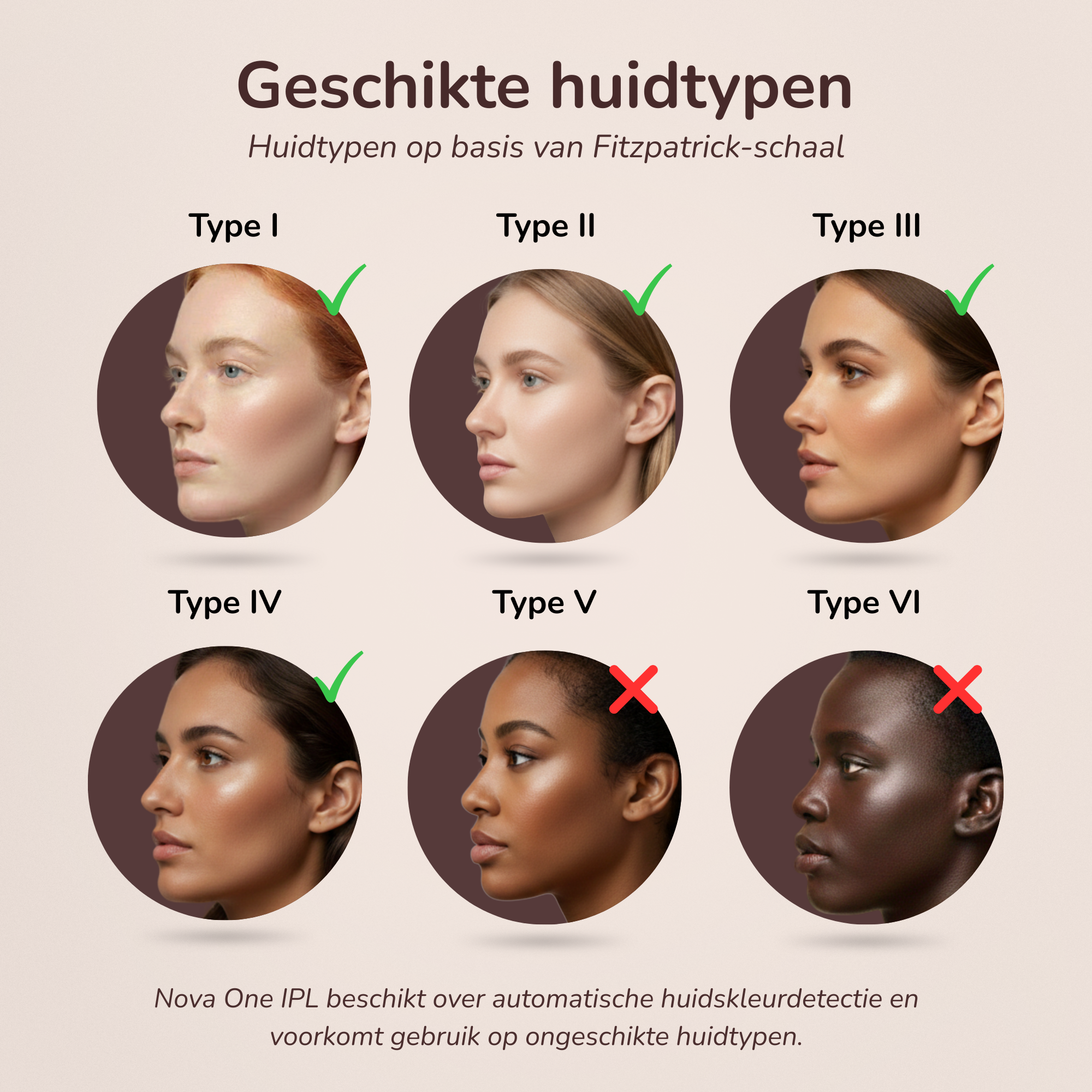 Overzichtsafbeelding van geschikte en niet-geschikte huidtypes voor de Laesera Nova One IPL volgens de Fitzpatrick-schaal. Geschikt voor huidtypes I, II, III en IV. Niet geschikt voor huidtypes V en VI. Het apparaat beschikt over automatische huidskleurdetectie om ongeschikt gebruik te voorkomen.