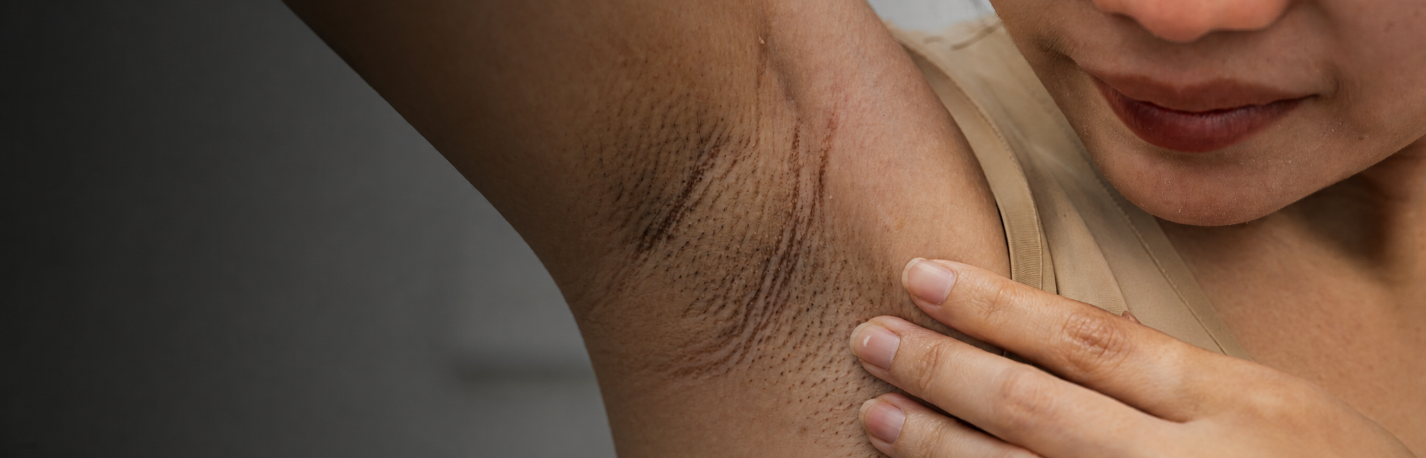 Smooth skin after an IPL treatment with the Laesera Nova One
