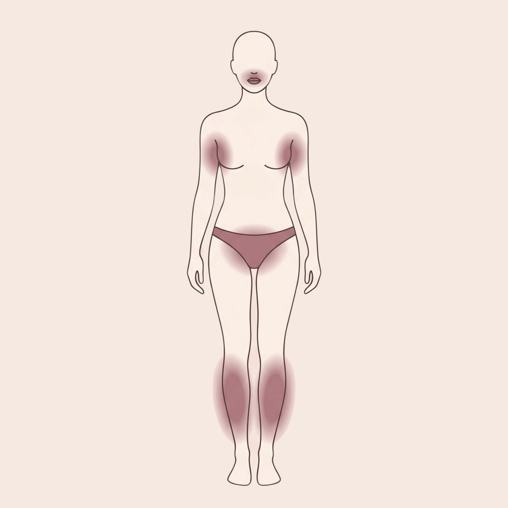 Overzicht van IPL behandelzones op het lichaam van een vrouw inclusief oksels, bikinilijn en onderbenen