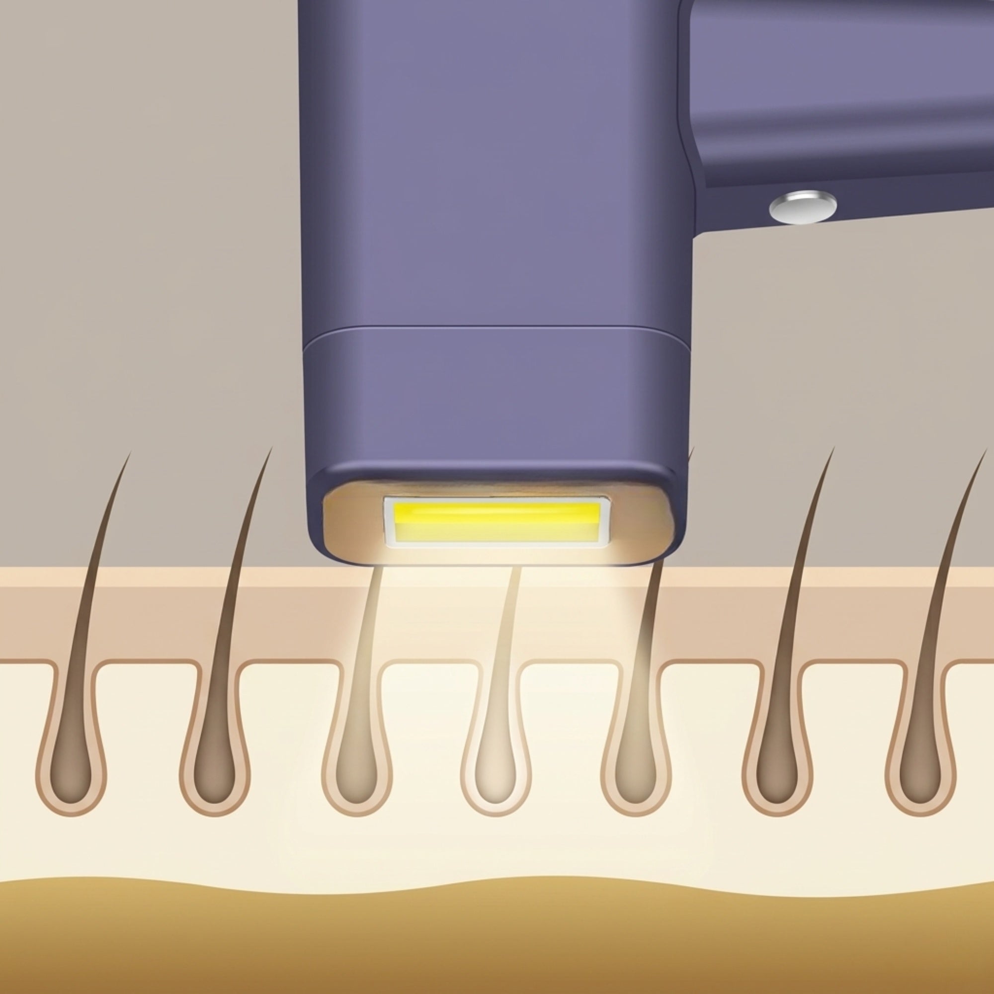 Een grafische weergave van een IPL-ontharingsapparaat dat lichtflitsen afgeeft op de haarzakjes in de verschillende huidlagen voor effectieve haarreductie.