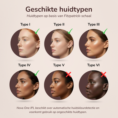 Overzichtsafbeelding van geschikte en niet-geschikte huidtypes voor de Laesera Nova One IPL volgens de Fitzpatrick-schaal. Geschikt voor huidtypes I, II, III en IV. Niet geschikt voor huidtypes V en VI. Het apparaat beschikt over automatische huidskleurdetectie om ongeschikt gebruik te voorkomen.
