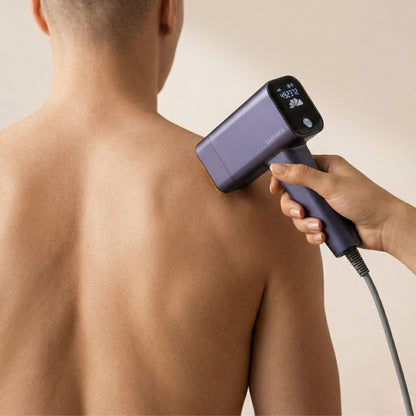 Dichtbij opname van de Nova One IPL die wordt gebruikt voor haarverwijdering op de rug van een man, met het digitale display zichtbaar.